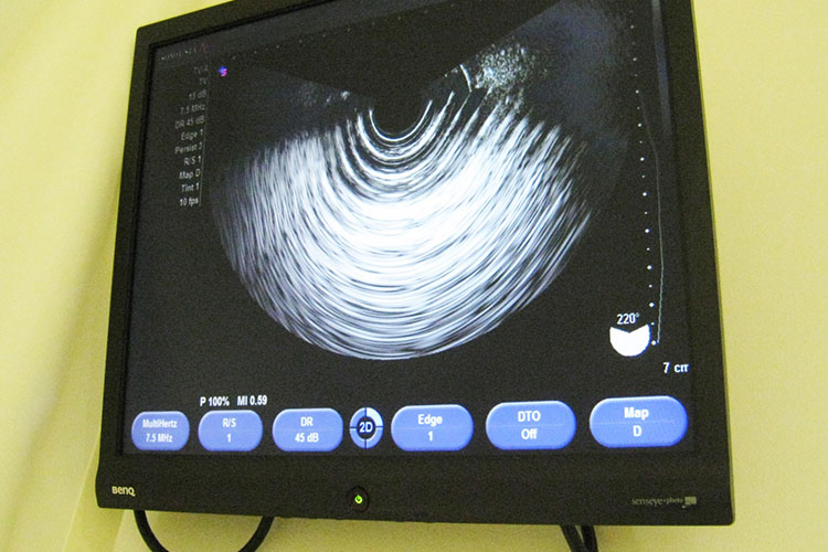 腹部超音波検査画像